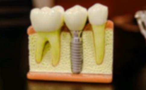 一次拔牙經(jīng)歷作文