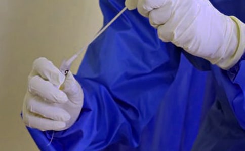 有關(guān)獸國的瘟疫寓言故事