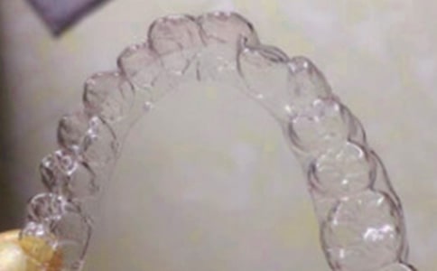 第一次戴牙套作文(通用26篇)