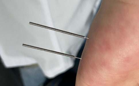 ��ᘾ�400������